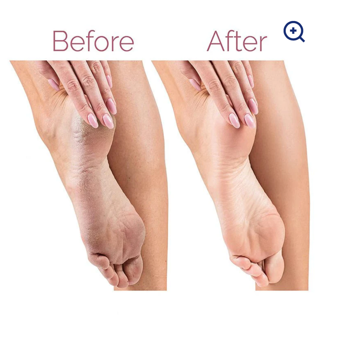 Electric Pedicure Foot File Callus Remover